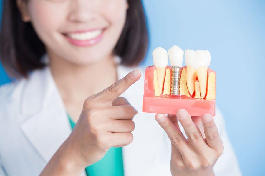 Implantes dentales en Majadahonda