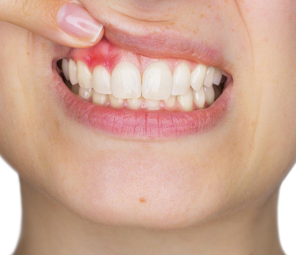 ¿Qué enfermedades evita la odontología conservadora?​