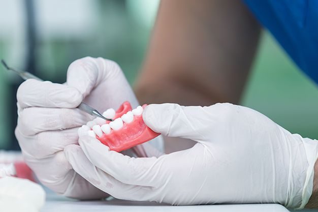 Carillas dentales sin tallado, un tratamiento que no afecta al resto de los dientes