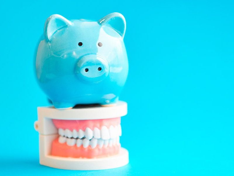 Implantes dentales por 250 euros, ¿dónde está el truco?