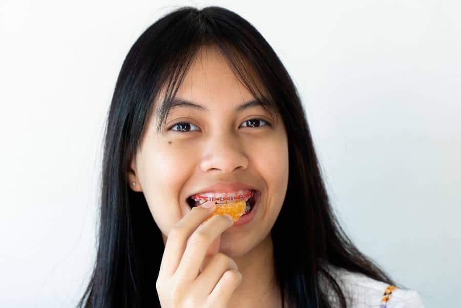 Alimentos que no se pueden comer con brackets