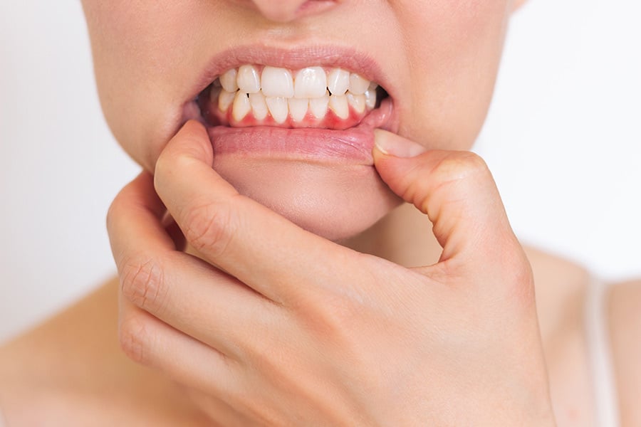 Encías inflamadas y dolor: causas y tratamientos
