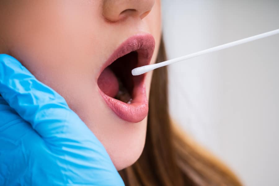 Posibles causas de la saliva ácida