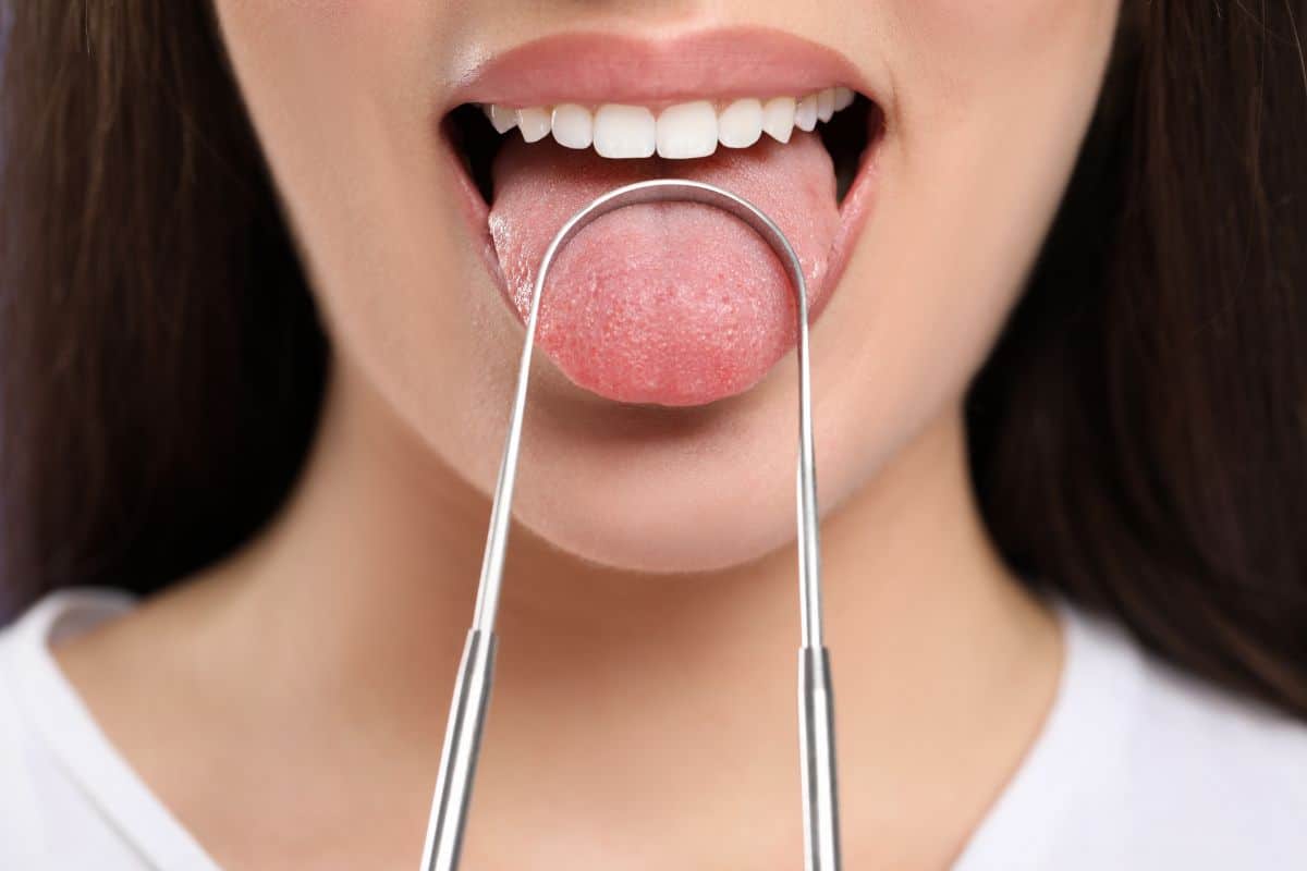 Prevención para la lengua blanca