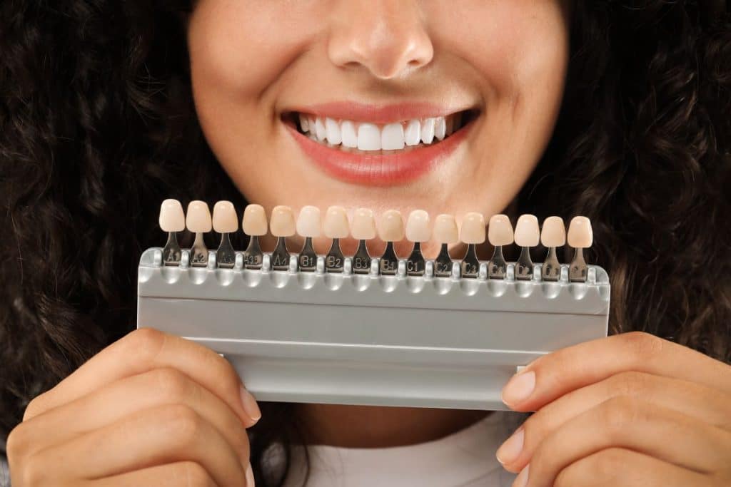 Tipos de carillas dentales
