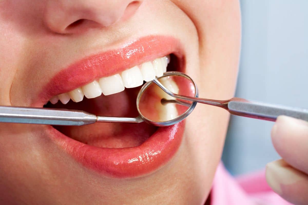 Duración empaste dental
