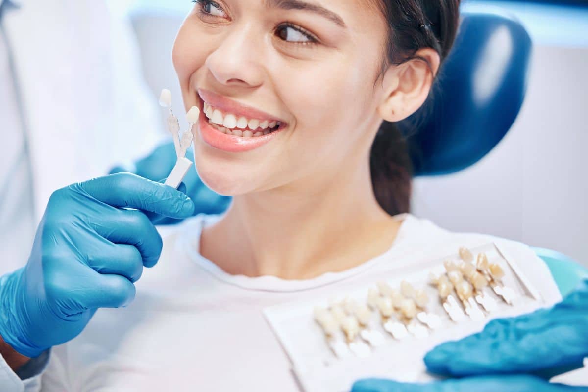 Requisitos para ponerse carillas dentales