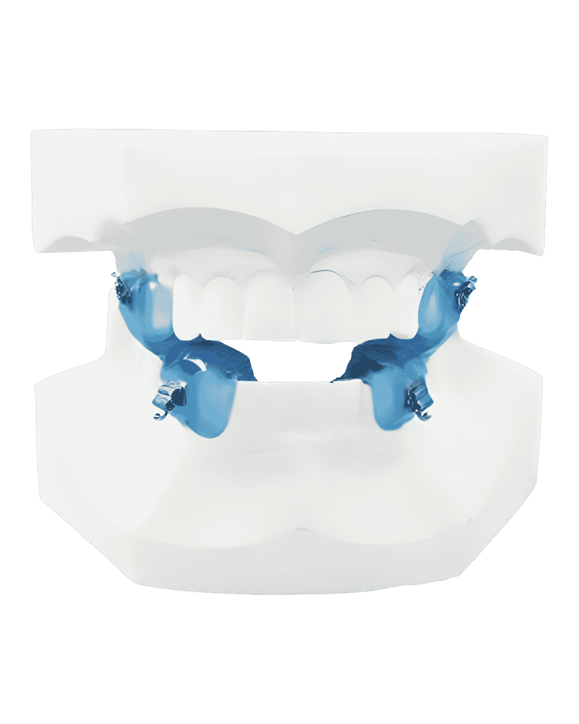 Dentadura con slide block 3D